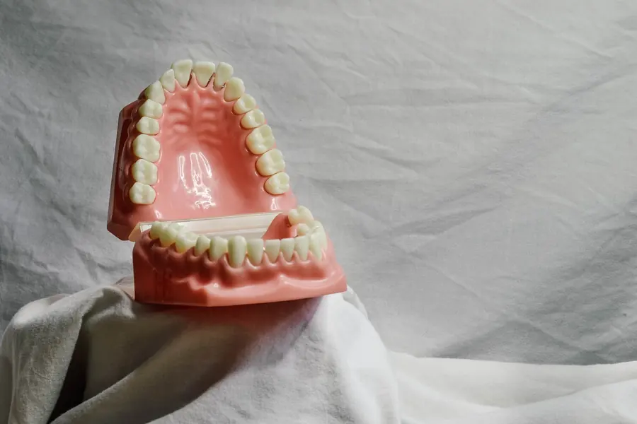 A dental model of the upper and lower teeth